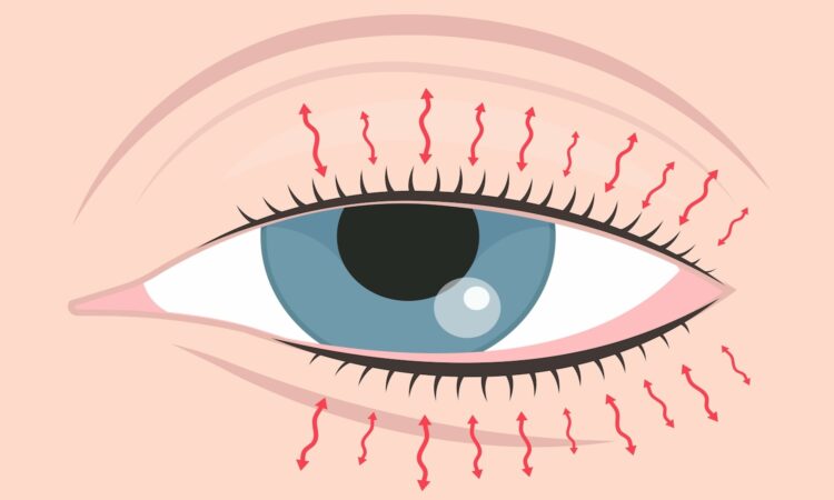 Oogarts waarschuwt: Dit is de rechte reden dat je soms last hebt van een trillend ooglid