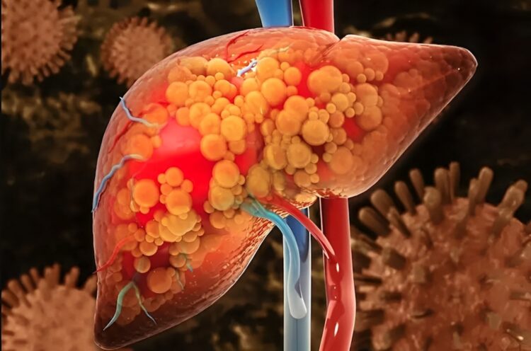 Negeer de signalen van een vervette lever niet! Zo herken je het…