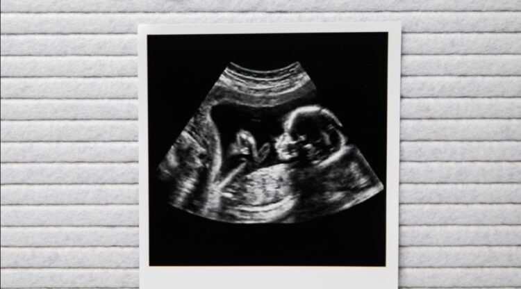 Babynieuws! Bij déze bekende familie is een baby op komst