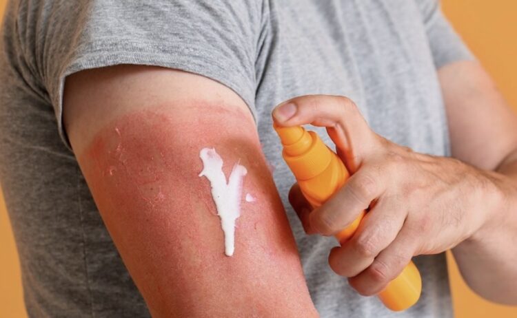 Let op! Consumentenbond waarschuwt: gebruik deze zonnebrandcrèmes niet meer