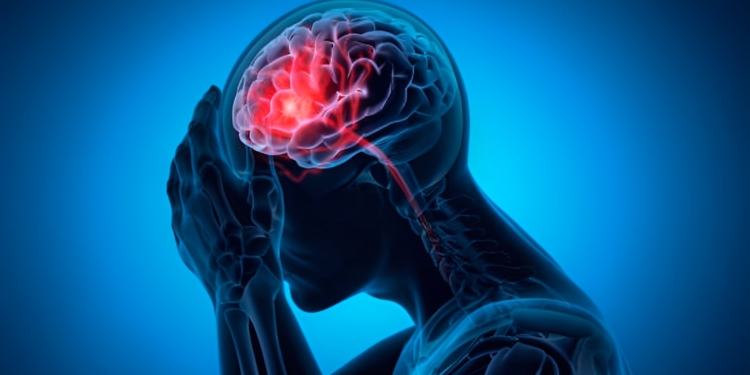 Opgepast: dit zijn de onverwachte voortekenen van een beroerte