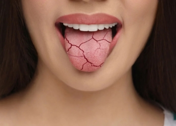 Verrassende redenen waarom je mond ’s nachts droog aanvoelt