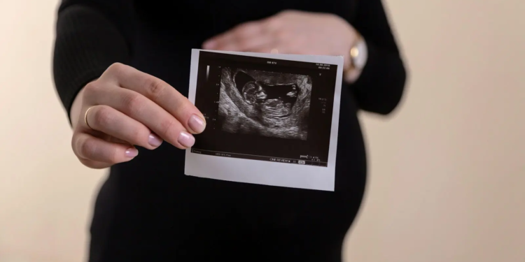 Prachtig babynieuws voor dit bekende Nederlandse realitykoppel: ‘een beetje overdonderd’