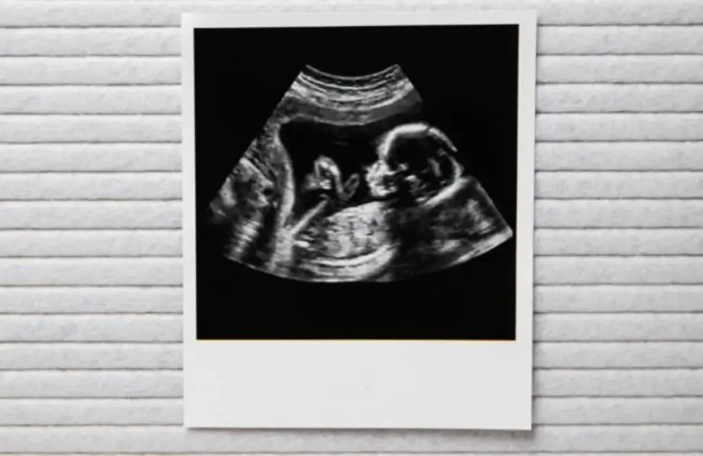 Geweldig babynieuws voor deze bekende actrice (52)