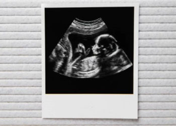 Geweldig babynieuws voor deze bekende actrice (52)